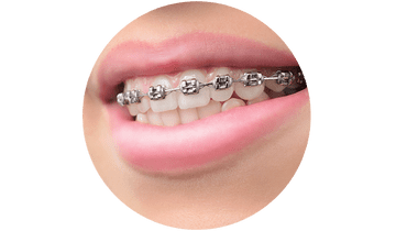 Brackets